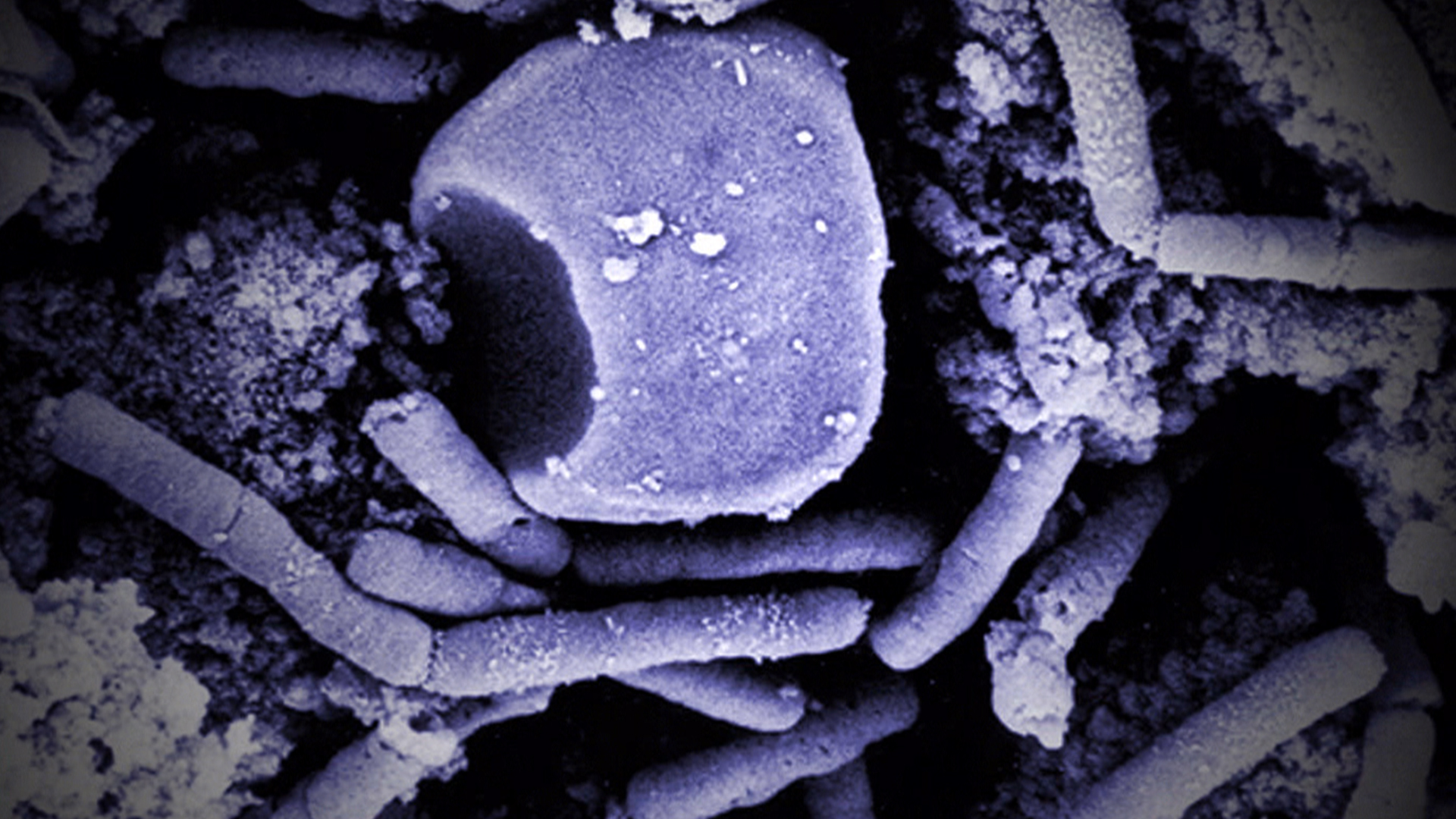 Клетка язвы. Bacillus anthracis Сибирская язва. Бактерия сибирской язвы под микроскопом. Сибиреязвенная бацилла под микроскопом.