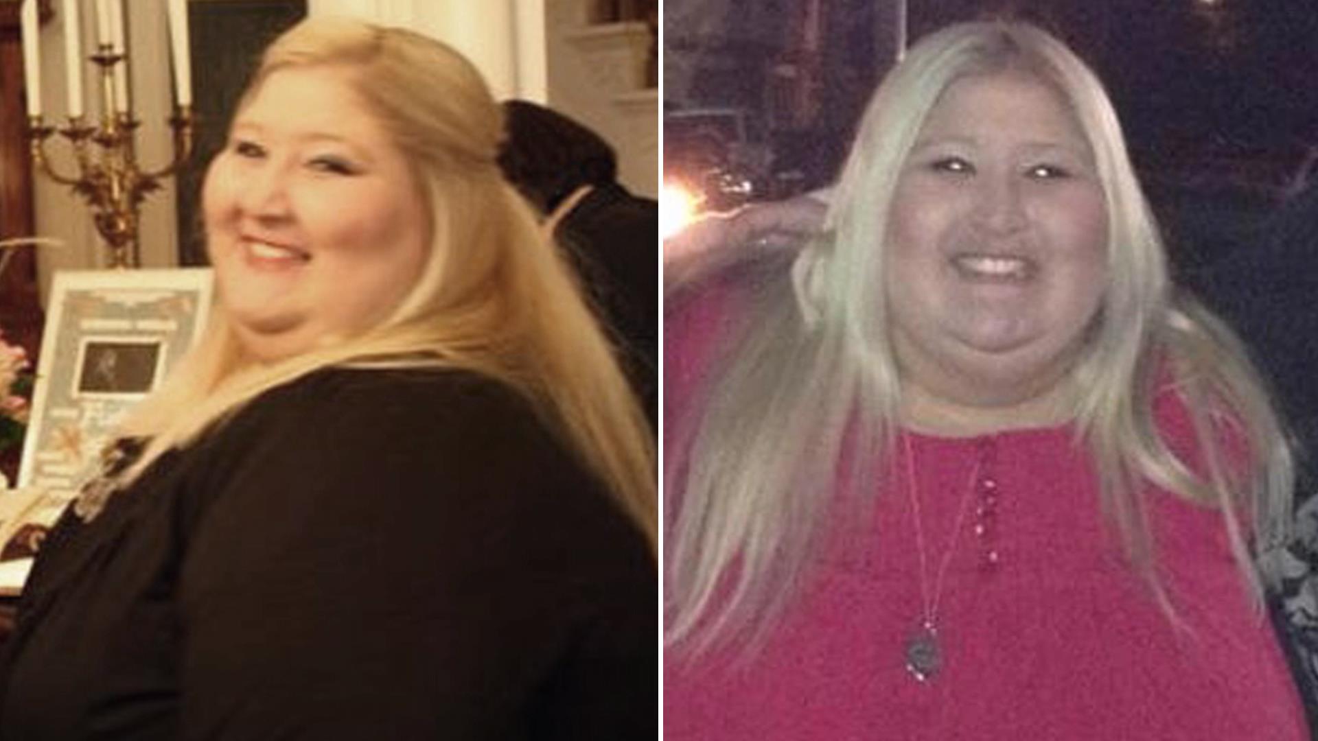 After losing 350 pounds, woman learns. 