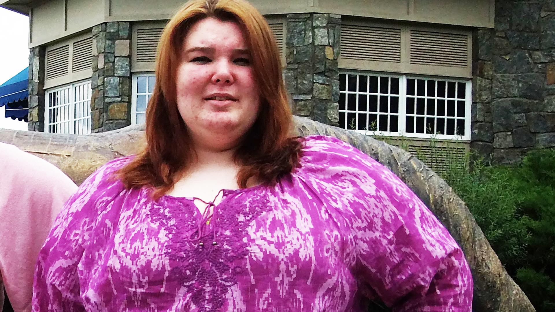 Woman loses 183 pounds in 2 years.