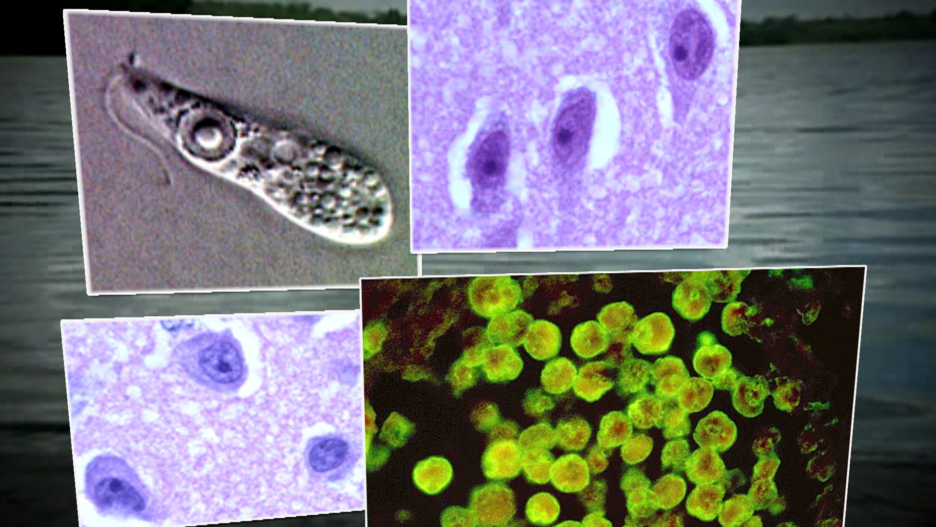 Brain eating amoeba. Амеба неглерия Фоулера. Неглерия Фоулера под микроскопом. Амеба паразит.