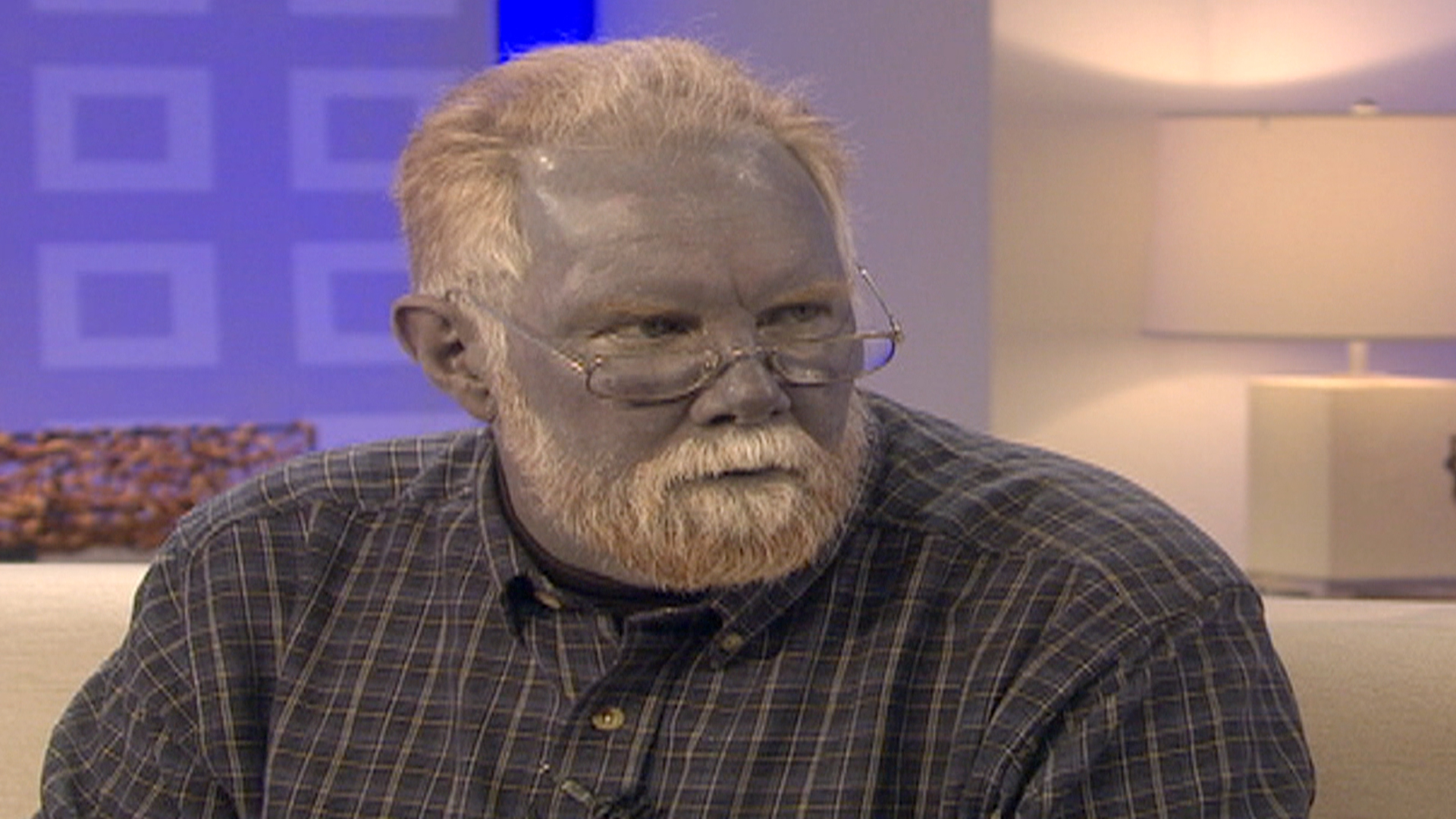 The man who turned blue 