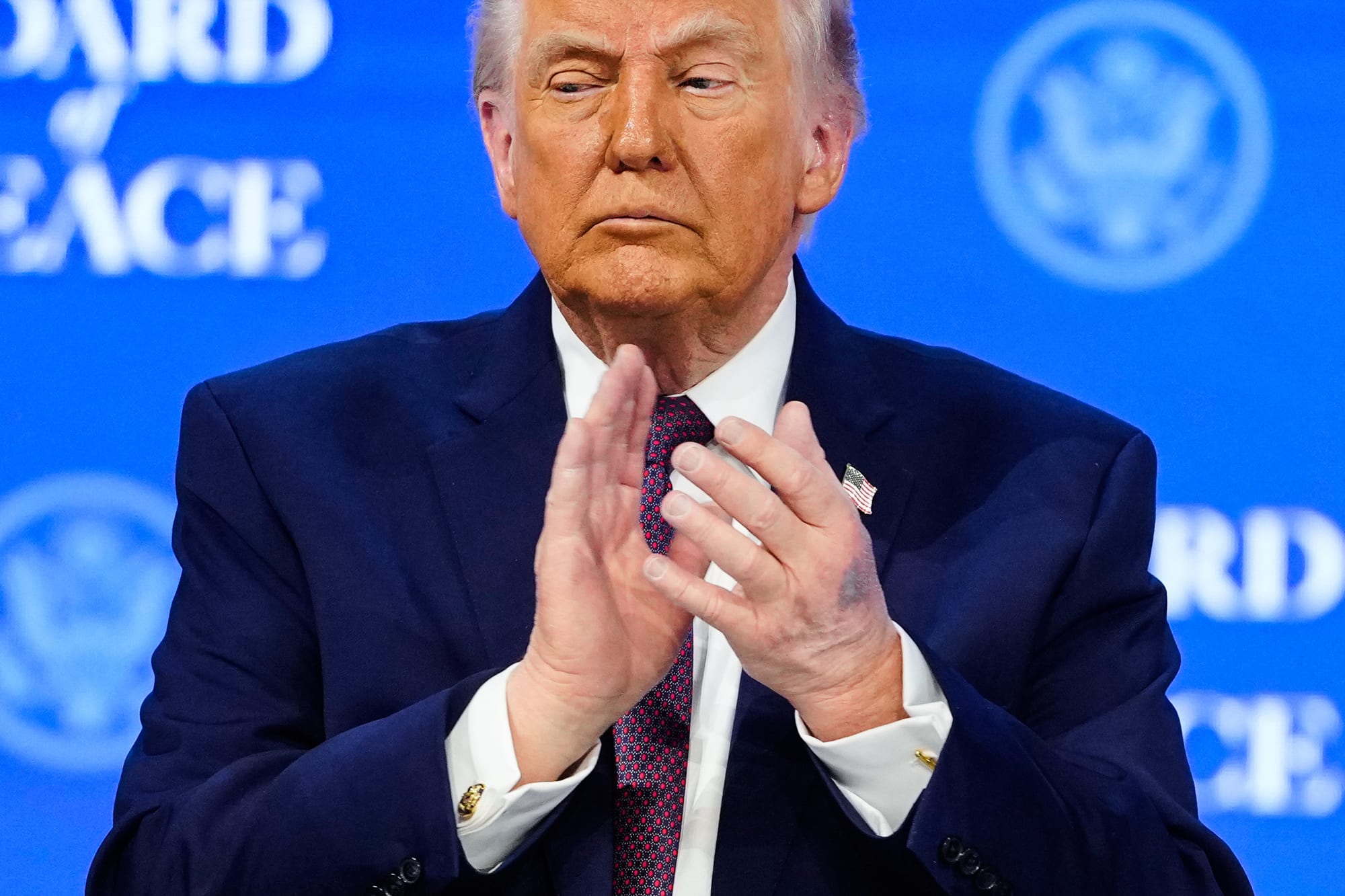 Trump claps his hands, a bruise can be seen on the back of one of them