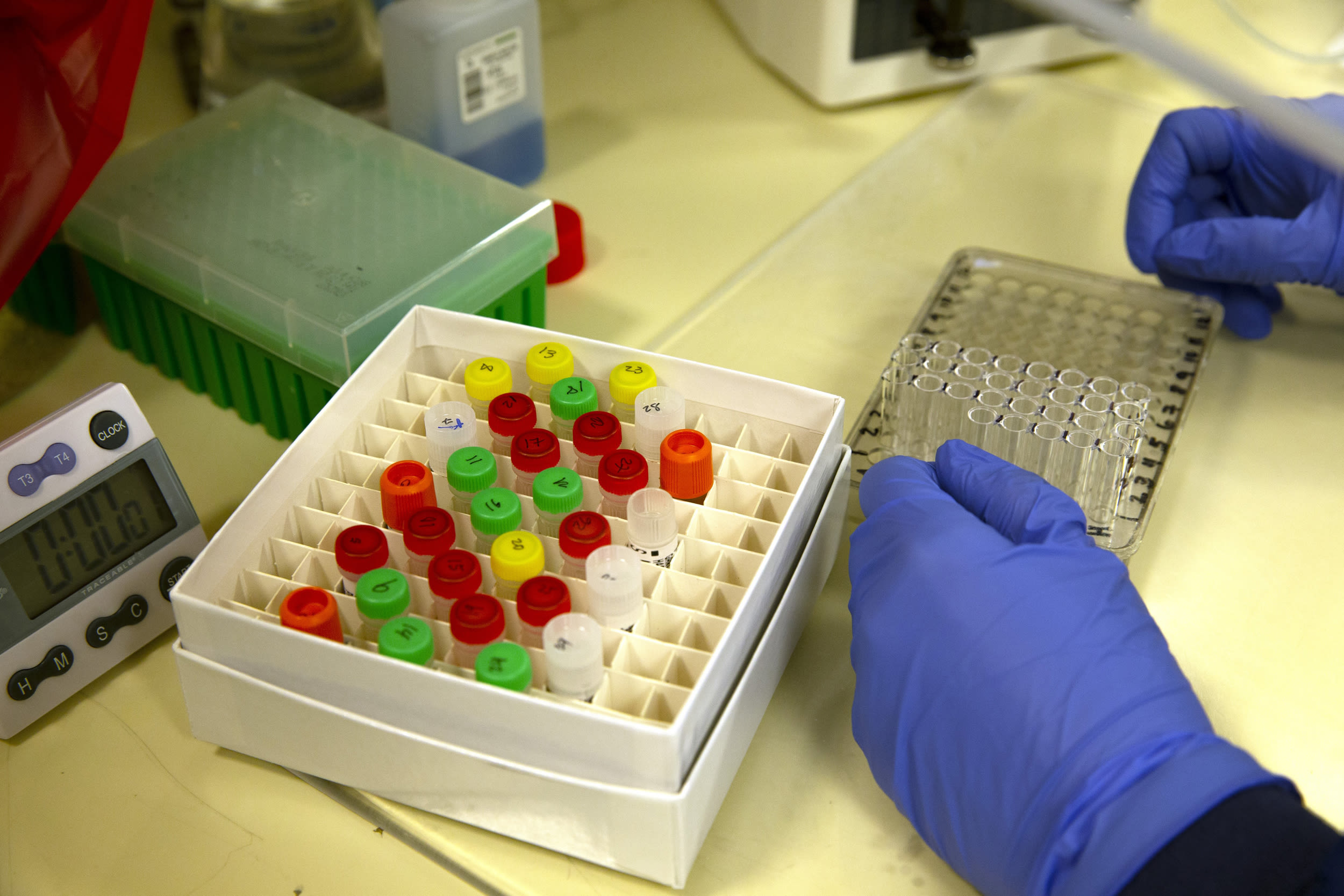 Image: University Of Washington Medicine Tests Blood Of Recovered COVID-19 Patients For Antibodies