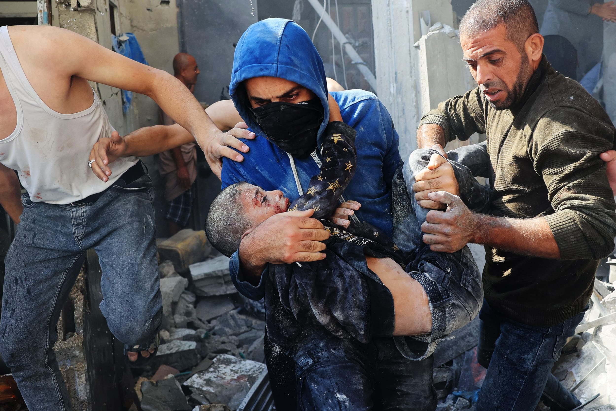 A Palestinian man carries an injured child in Rafah, southern Gaza Strip, on Nov. 7, 2023.