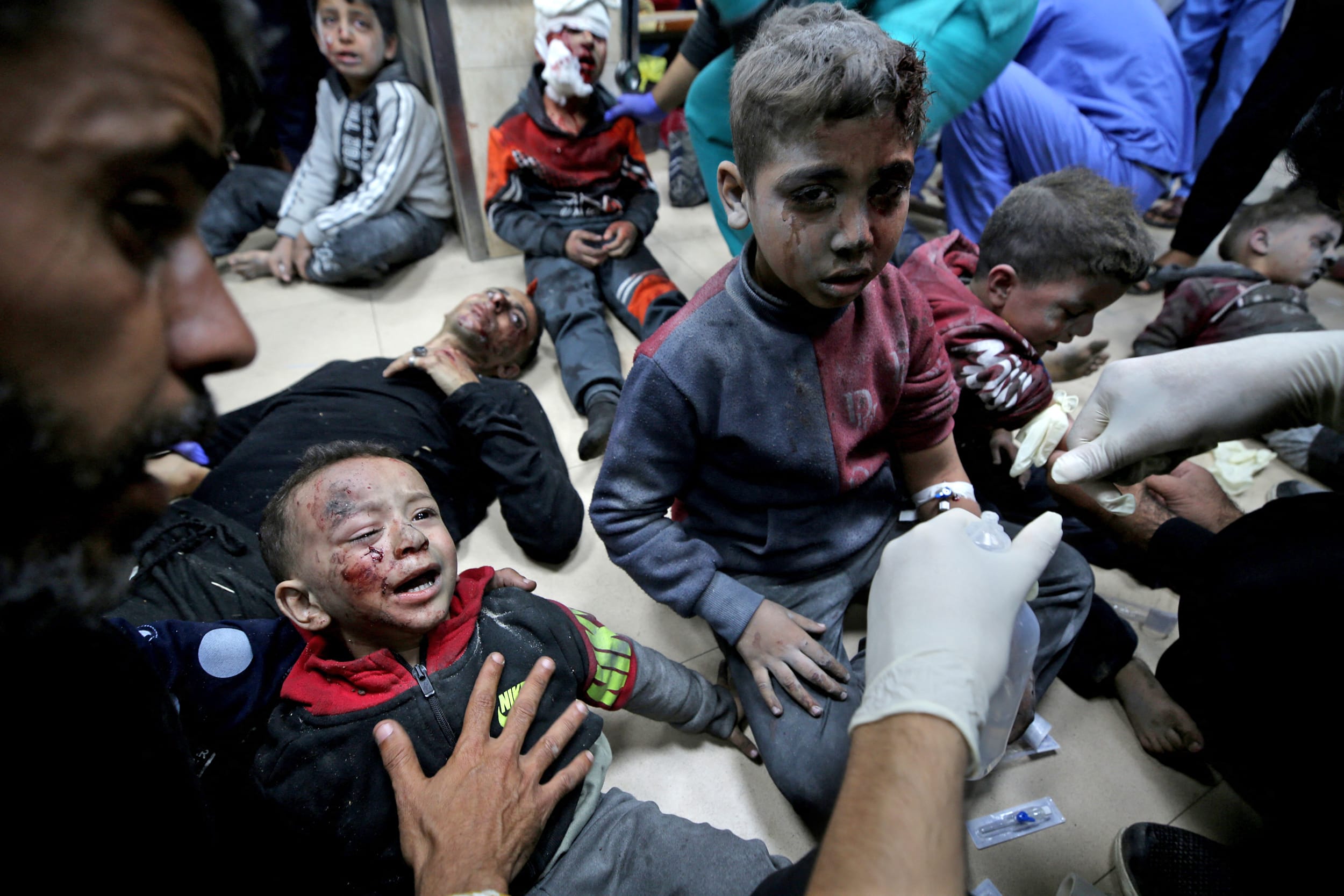 Injured Palestinians injured following strikes on al-Maghazi refugee camp receive care at Al-Aqsa hospital in Deir Balah in the central Gaza Strip on Dec. 11, 2023.