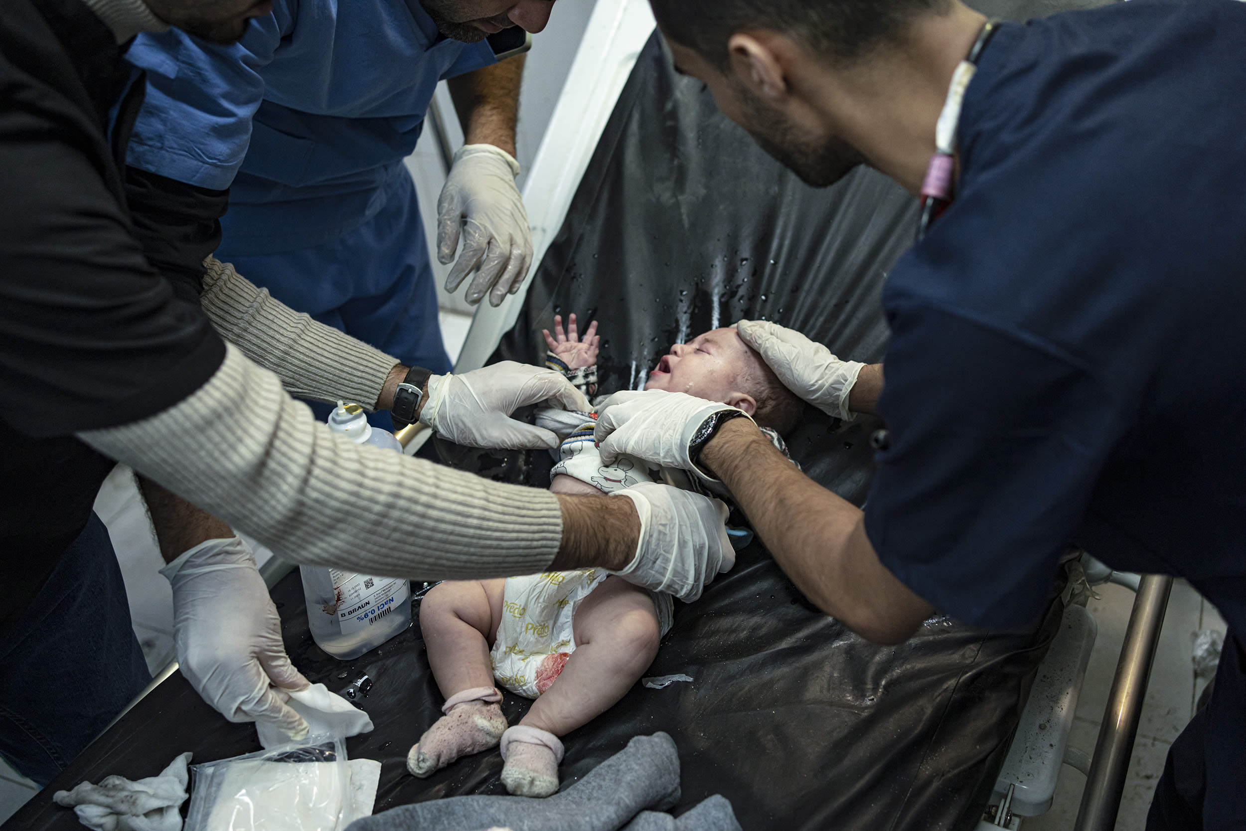 Palestinian Child Wounded In Gaza