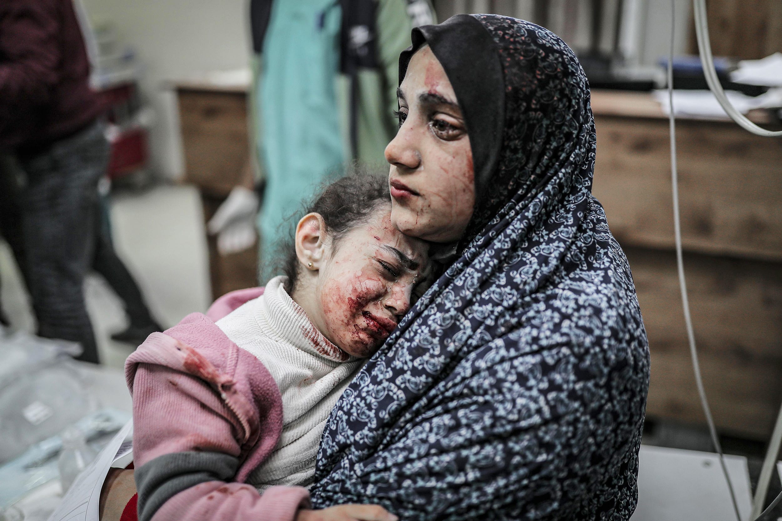 A mother and daughter sit in a hospital, faces are bloody