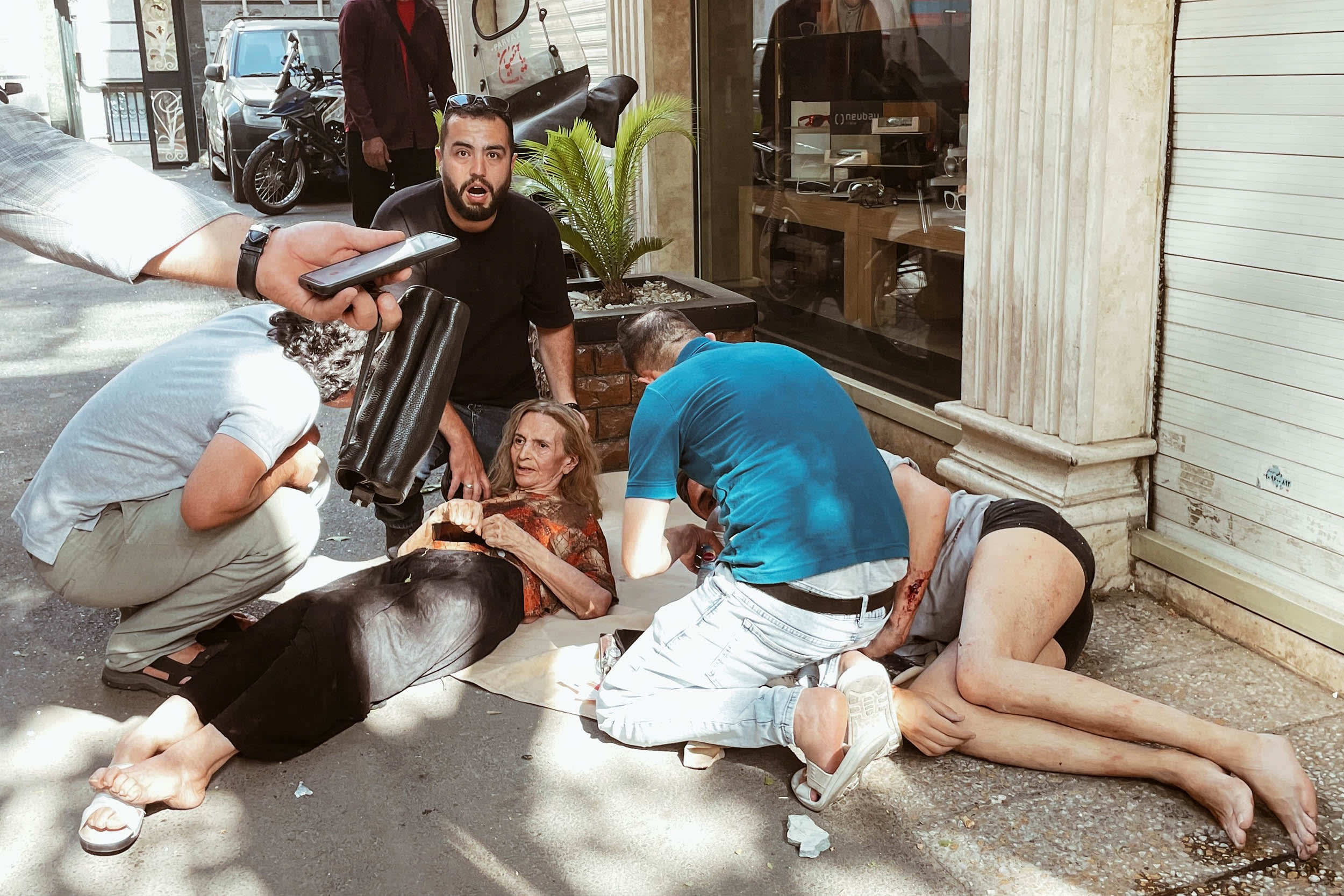 Iranian-Injured-after-Israeli-Attack