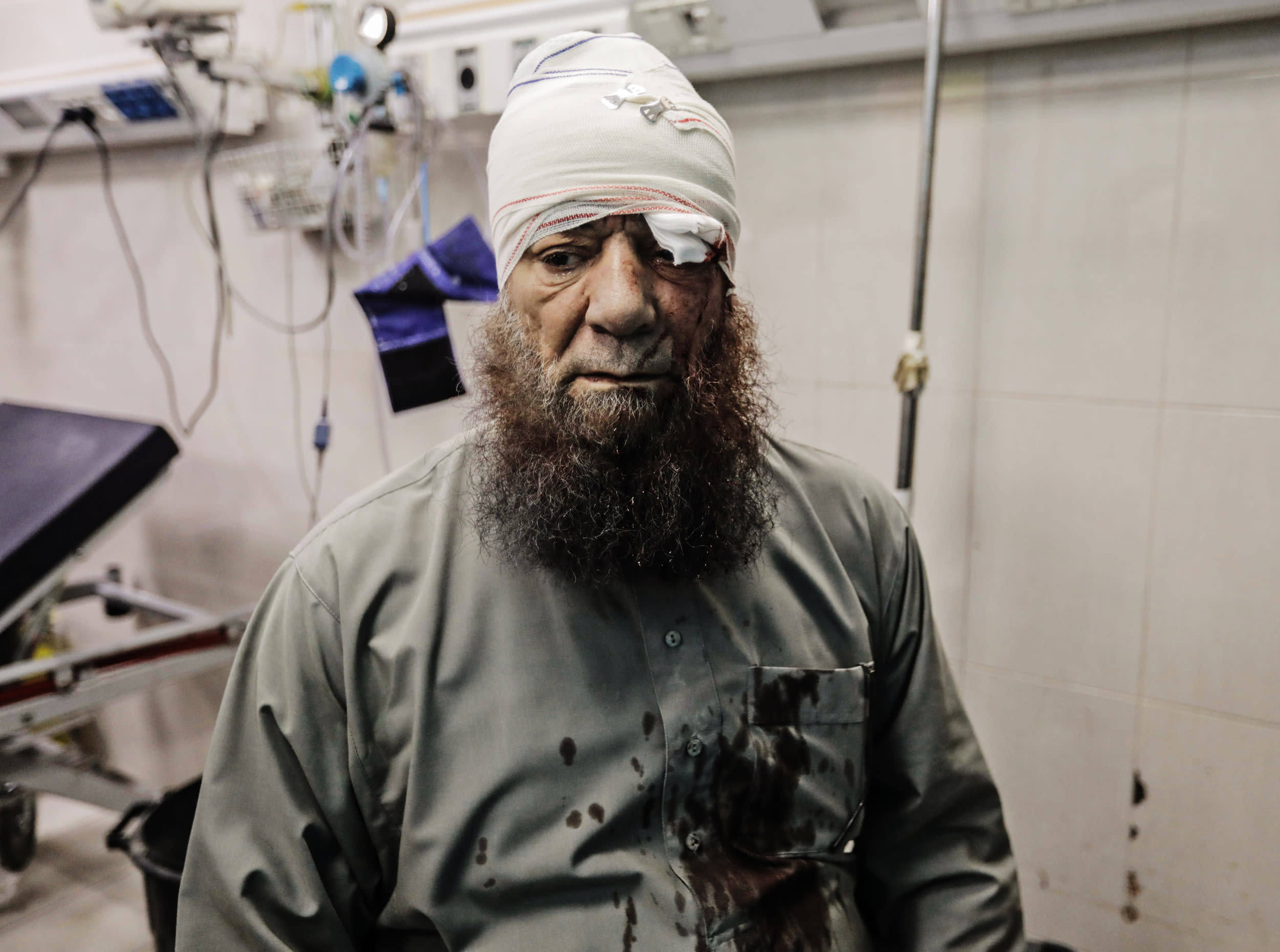 An injured Palestinian man at Nasser Hospital on Nov. 14, 2023 in Khan Younis, Gaza. 
