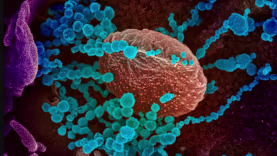 What to do if you think a family member has coronavirus