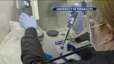 New clinical trial underway for possible coronavirus treatment: exclusive