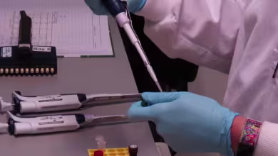 Labs around the world race to find COVID-19 vaccine