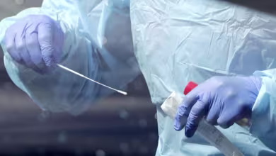 People who’ve had coronavirus should beware ‘false sense of security,’ doctor says