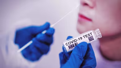 The state of COVID-19 testing in the US