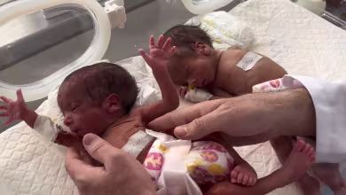 Rafah's Emirati Hospital sees rise in premature births and underweight neonates