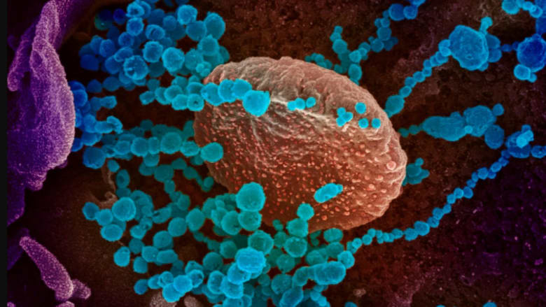 What to do if you think a family member has coronavirus