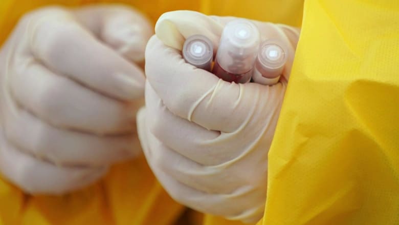 FDA authorizes use of antimalarial drugs for coronavirus treatment