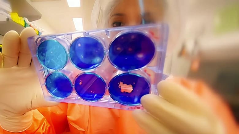 Clinical trials underway in race for coronavirus vaccine