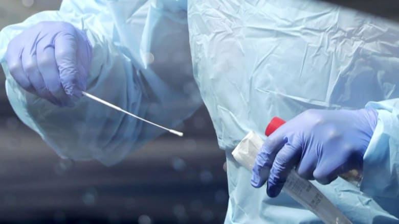 People who’ve had coronavirus should beware ‘false sense of security,’ doctor says