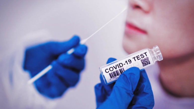 The state of COVID-19 testing in the US