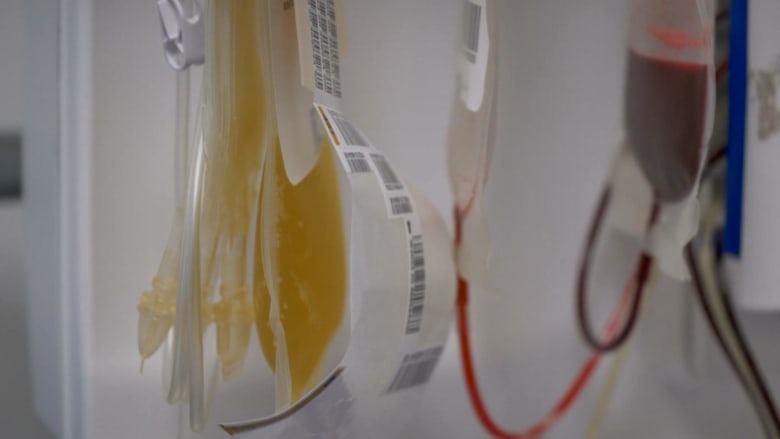 Timing and Covid antibodies key for plasma treatment effectiveness, new study finds