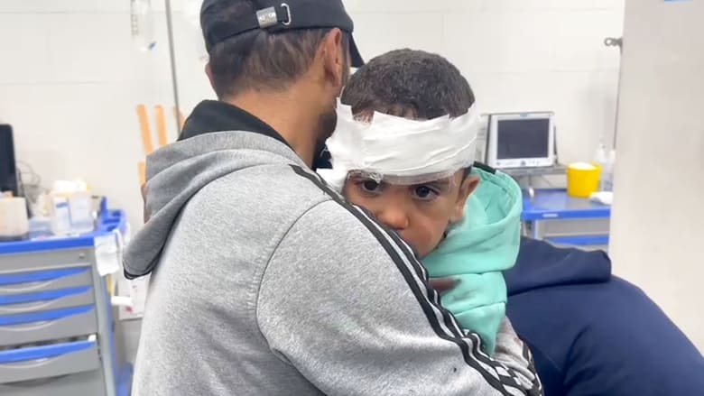 Wounded children treated at Gaza hospital after Rafah airstrike