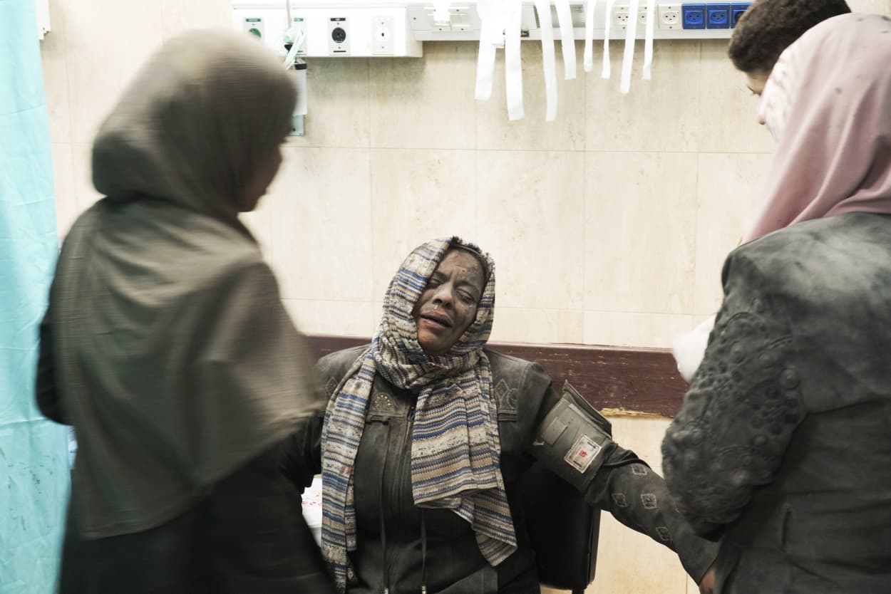 An injured Palestinian woman receives medical treatment in a hospital 