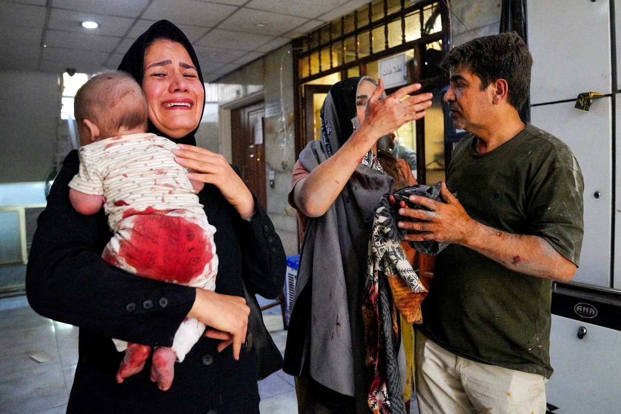 A crying woman carries an injured baby