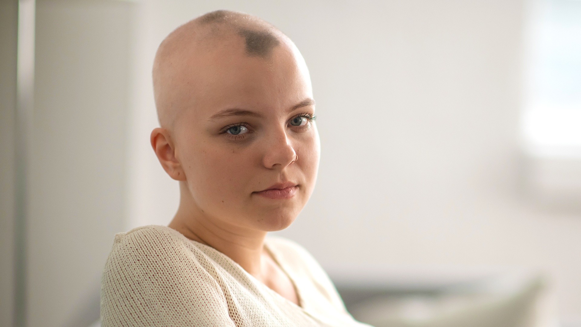 Alopecia treatment top