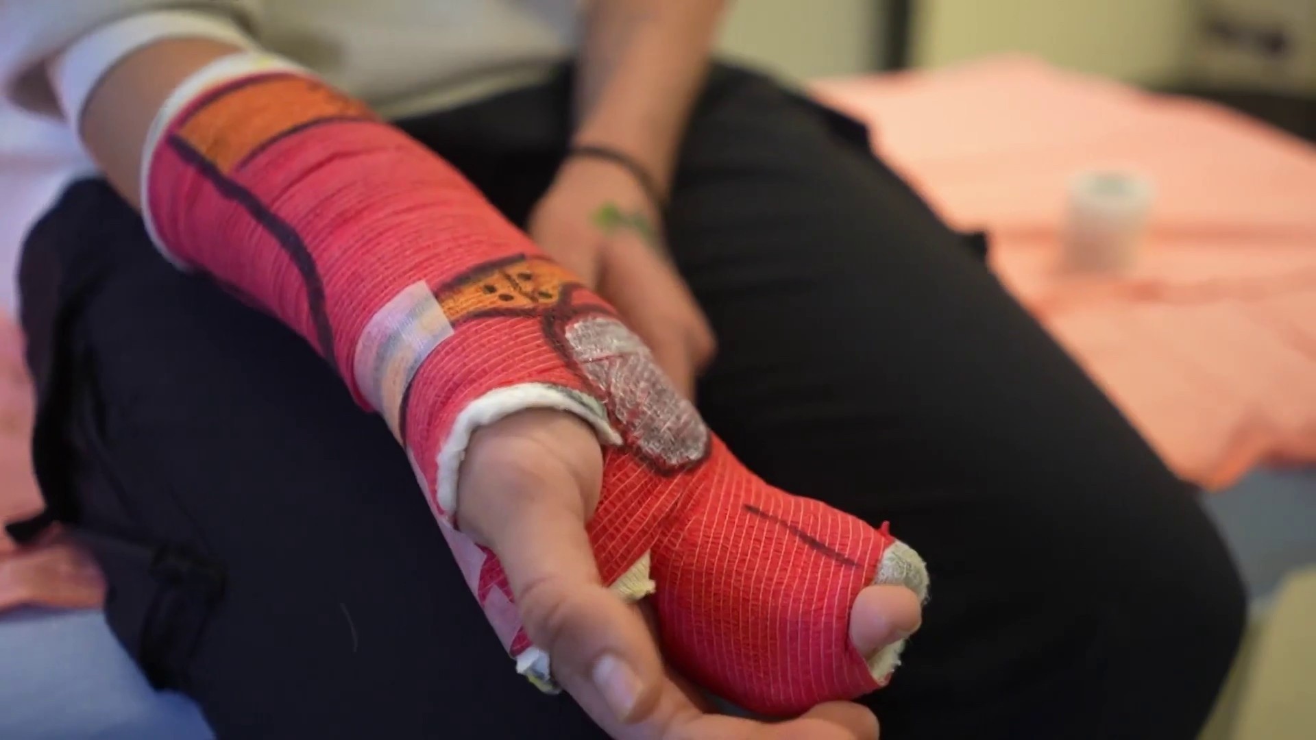 This medical worker puts smiles on young patients faces with cast art