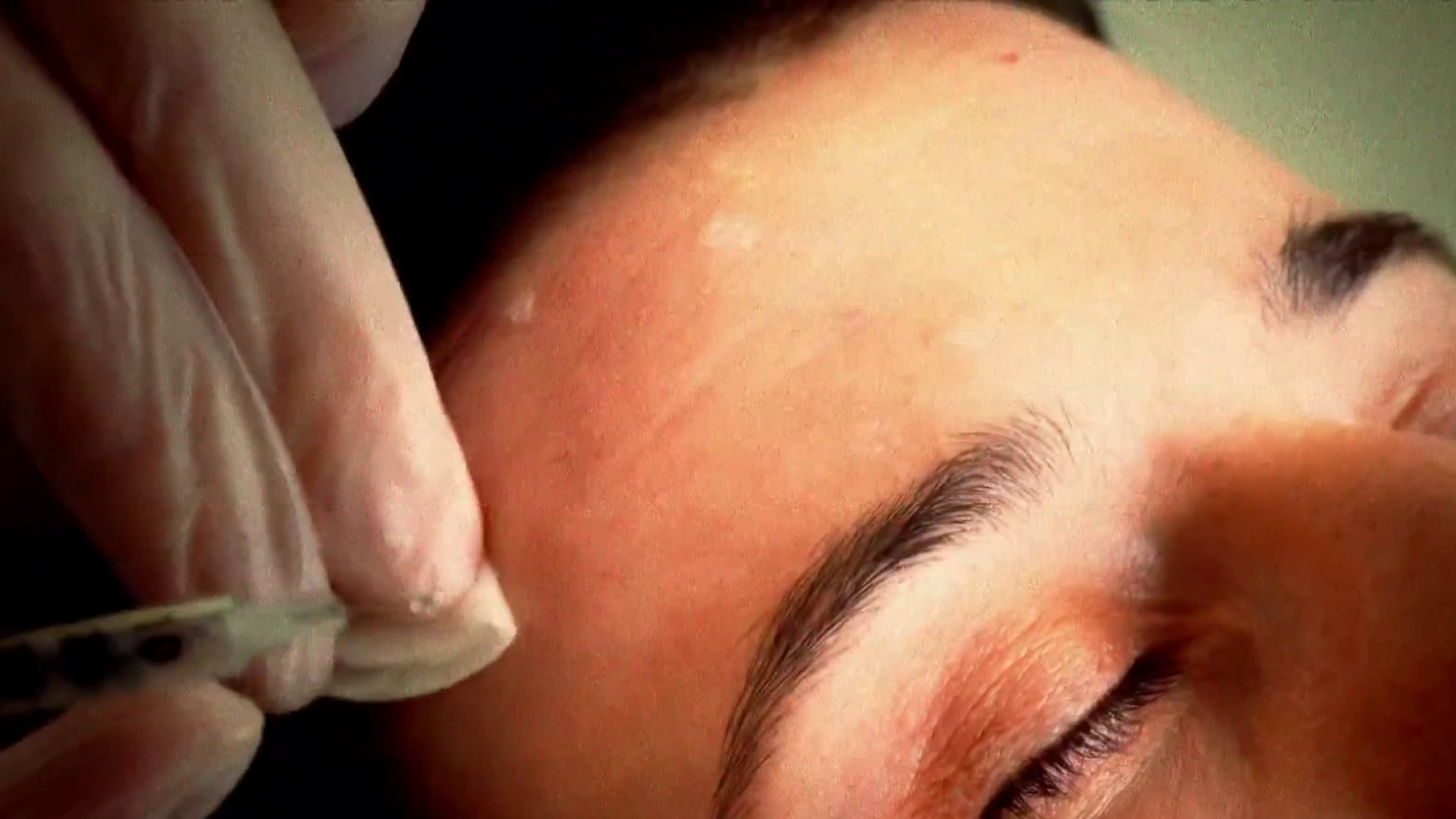 Federal regulators issue warning as med spas surge across U.S
