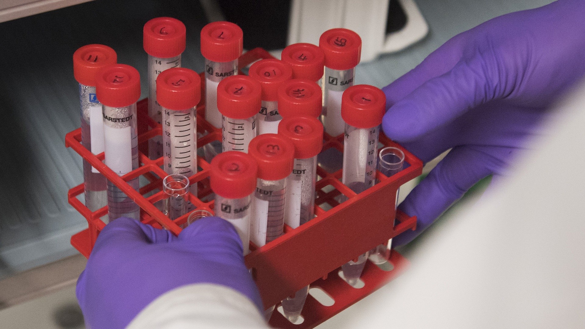 New study shows how effective immunotherapy is at battling cancer