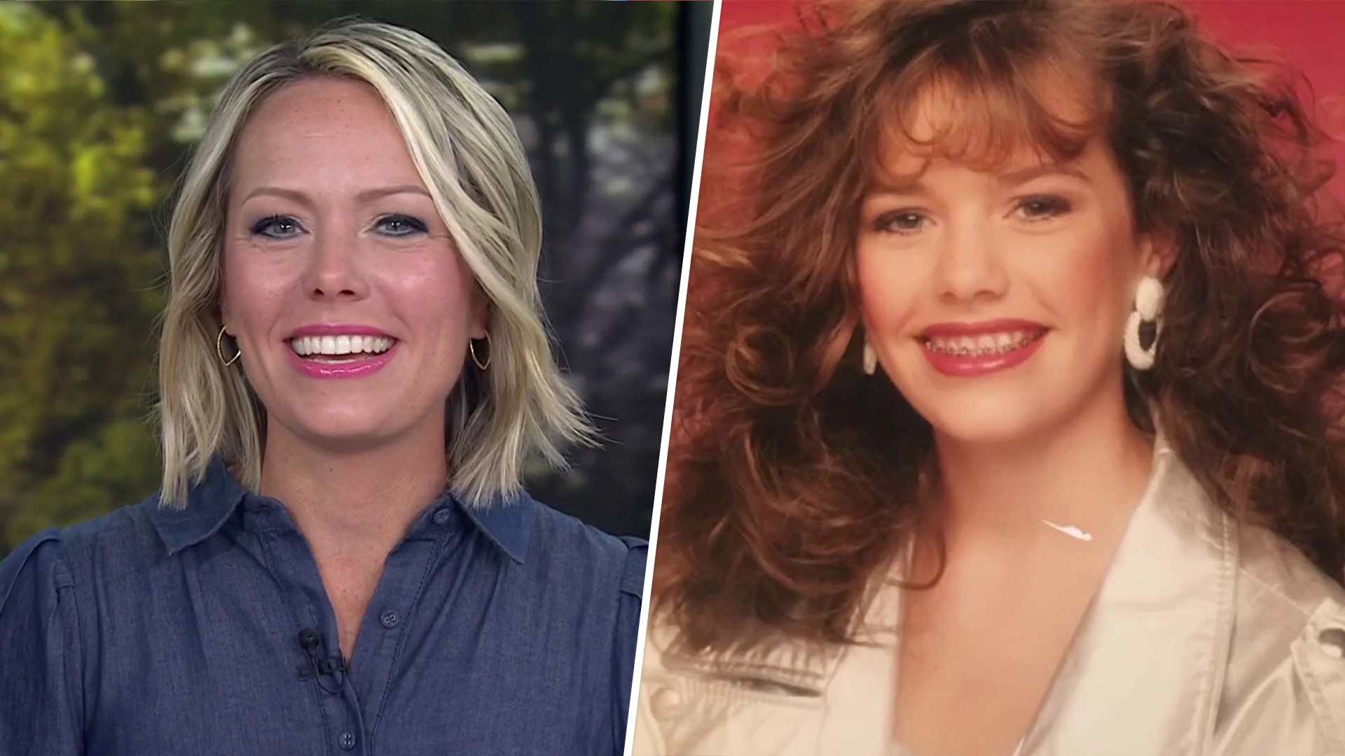 Metal Braces Are Back! TODAY Anchors Share Throwback Pics