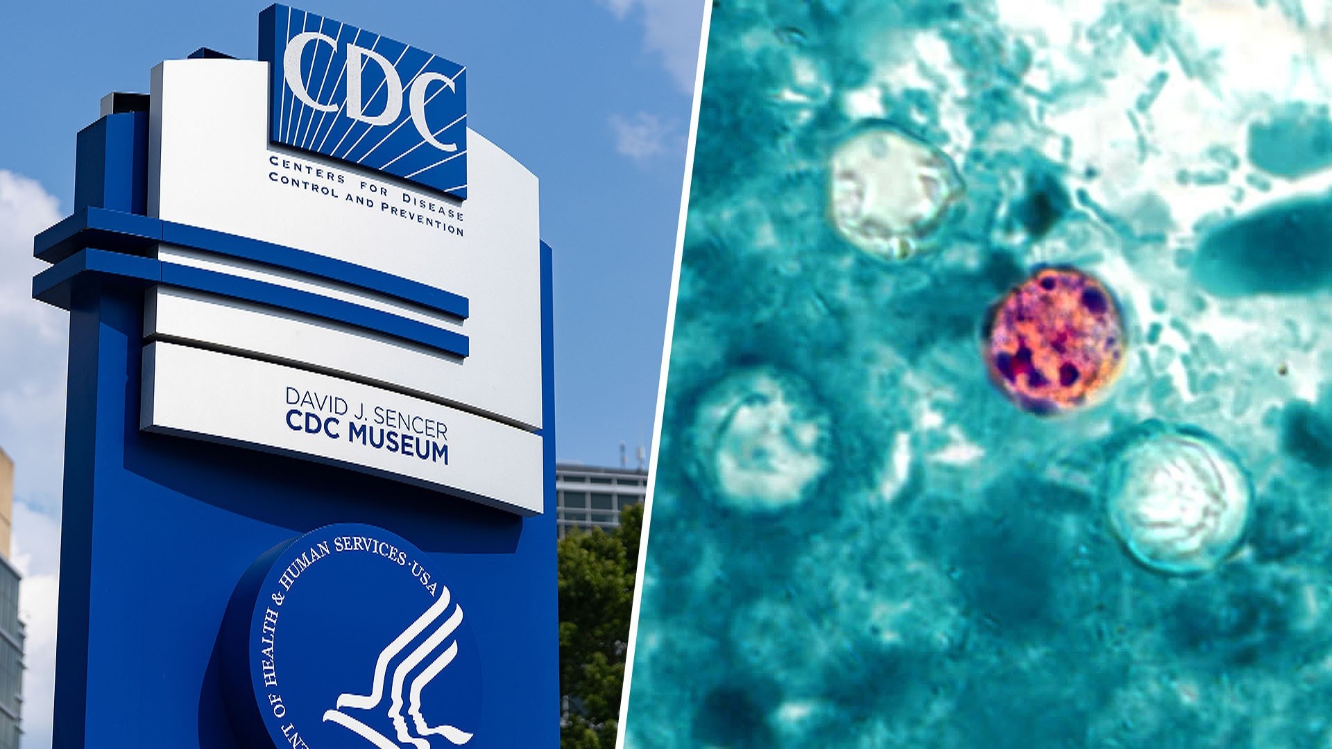 New CDC Data Signal Downward Trend in Cyclospora Outbreak
