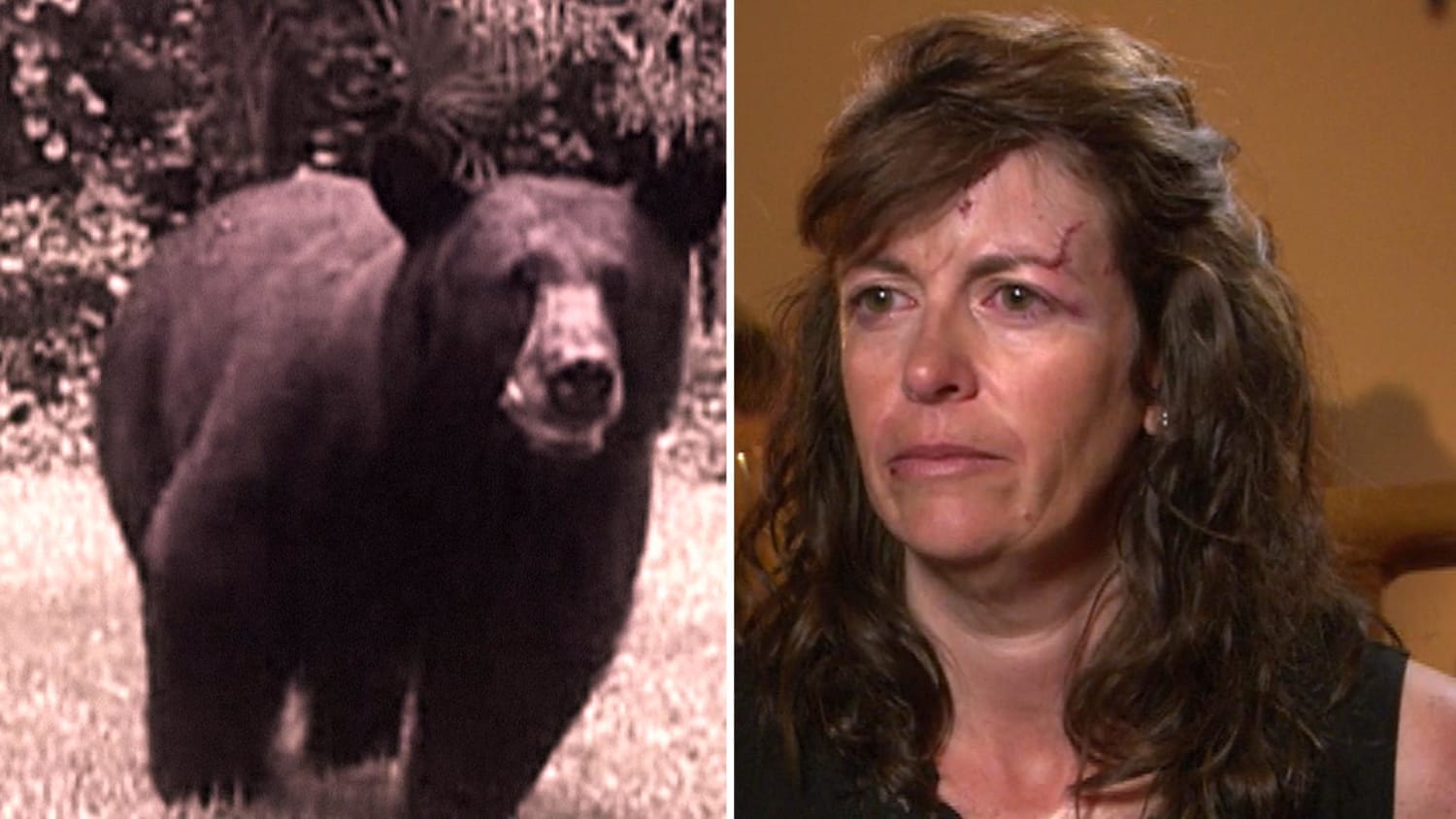 Woman Attacked By Bear