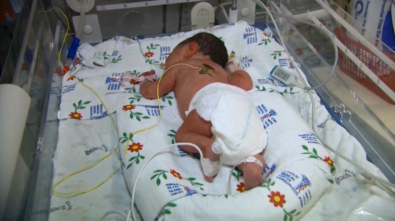 black premature babies in incubators