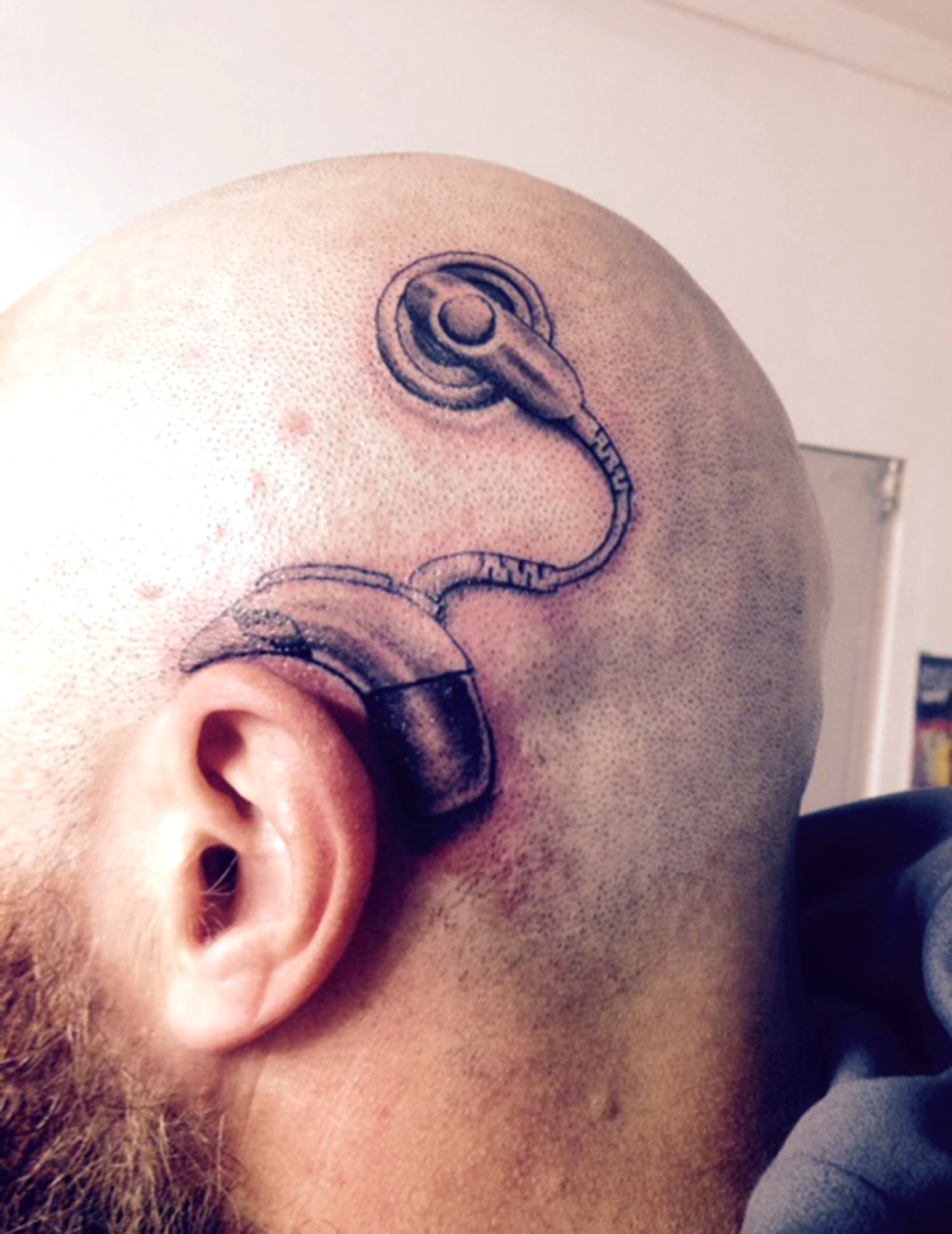 Cochlear implant tattoo