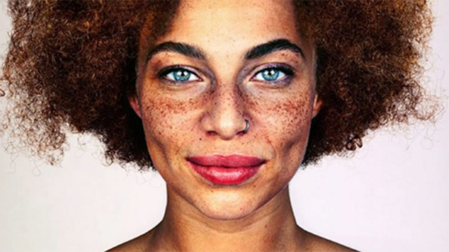 freckles african americans