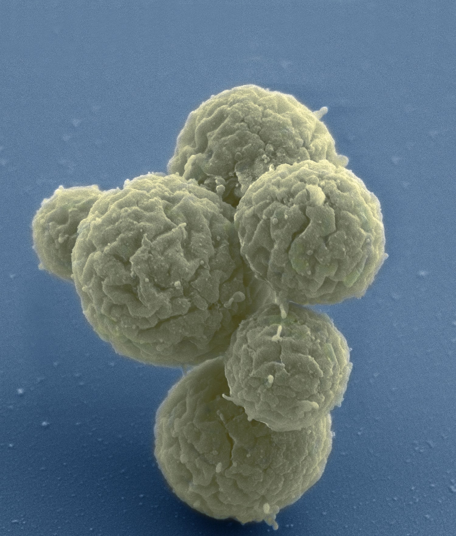 160324-stripped-down-life-form