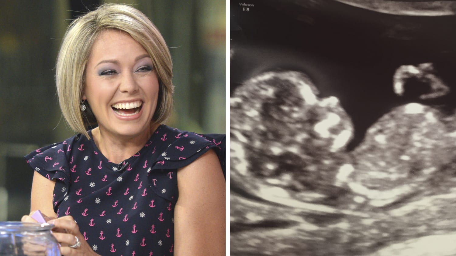Dylan Dreyer says she's a roller coaster of emotions in first weeks of...