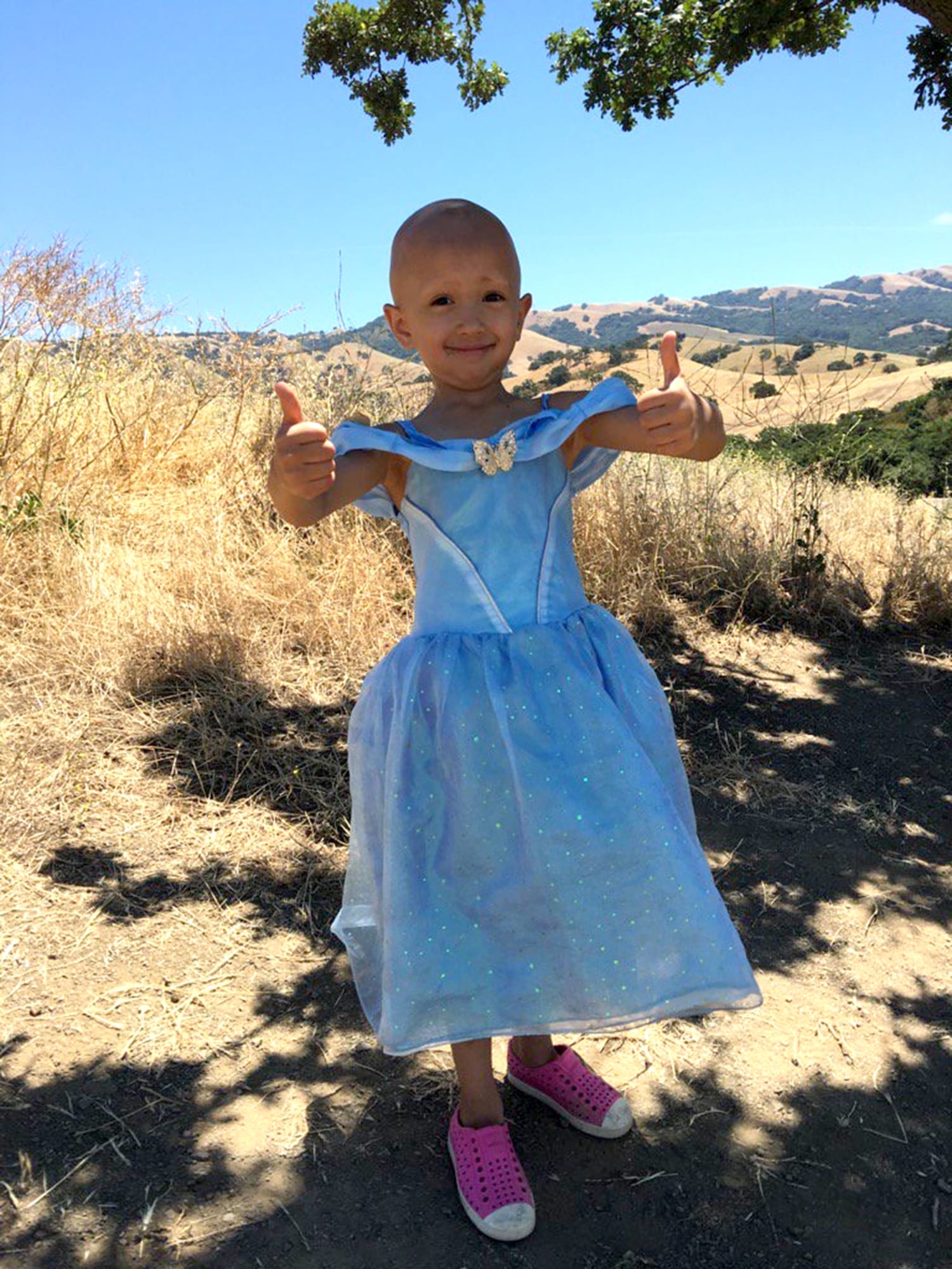 Meet the 4-year-old fashion designer with alopecia who's making