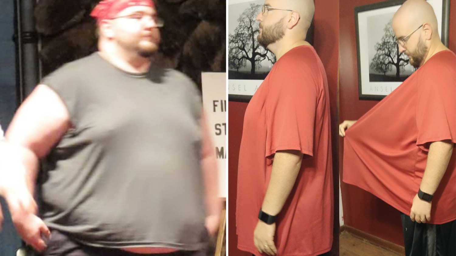 Man Lost 400 Pounds without Surgery 