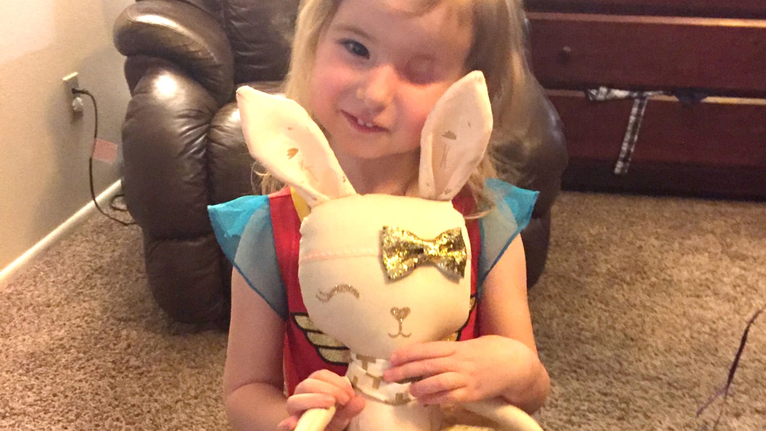 Girl who lost eye to cancer adores bunny doll with one eye