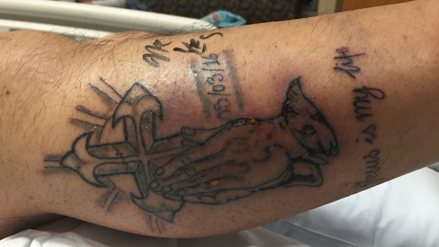 31-year-old man dies after swimming with fresh tattoo