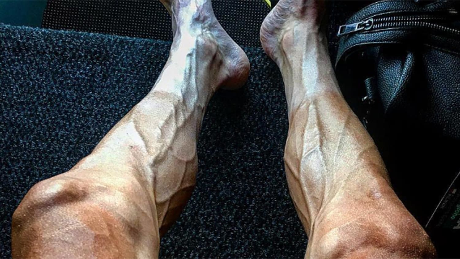 Cyclist shows what competing in the Tour de France can do to your legs