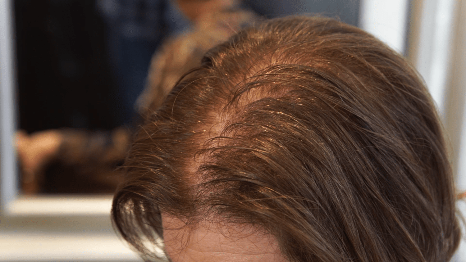 8 Myths and Truths about Hair Loss | ISDIN