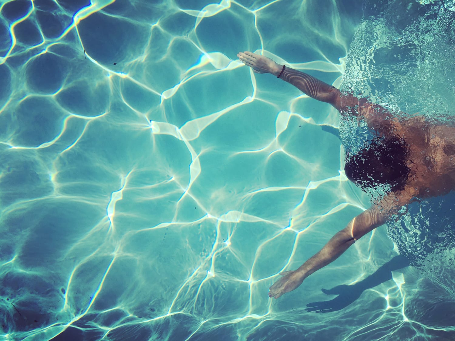 Hard-to-kill germs may be lurking in your hotel pool, CDC says
