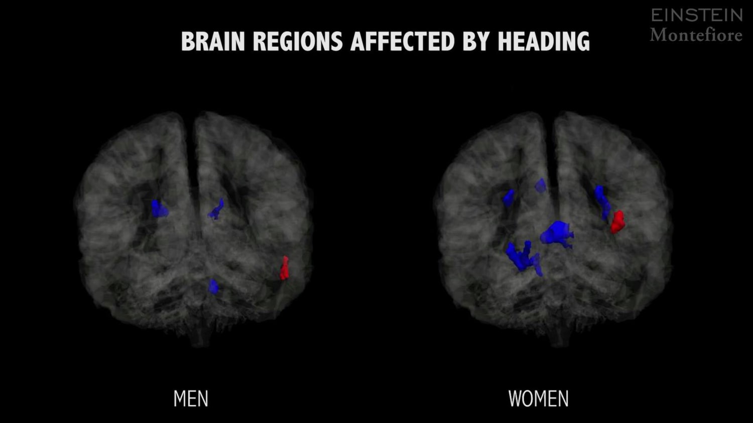 When Head Meets Soccer Ball, How Does Your Brain Fare?