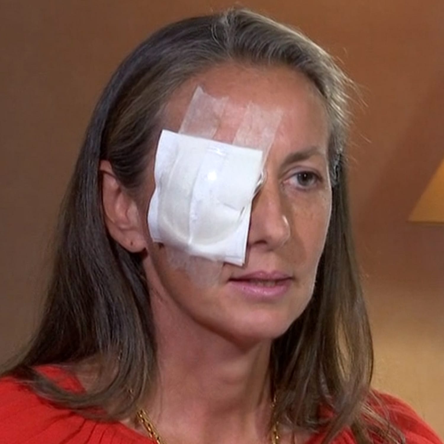 Woman blinded by errant golf shot angry at Ryder Cup officials