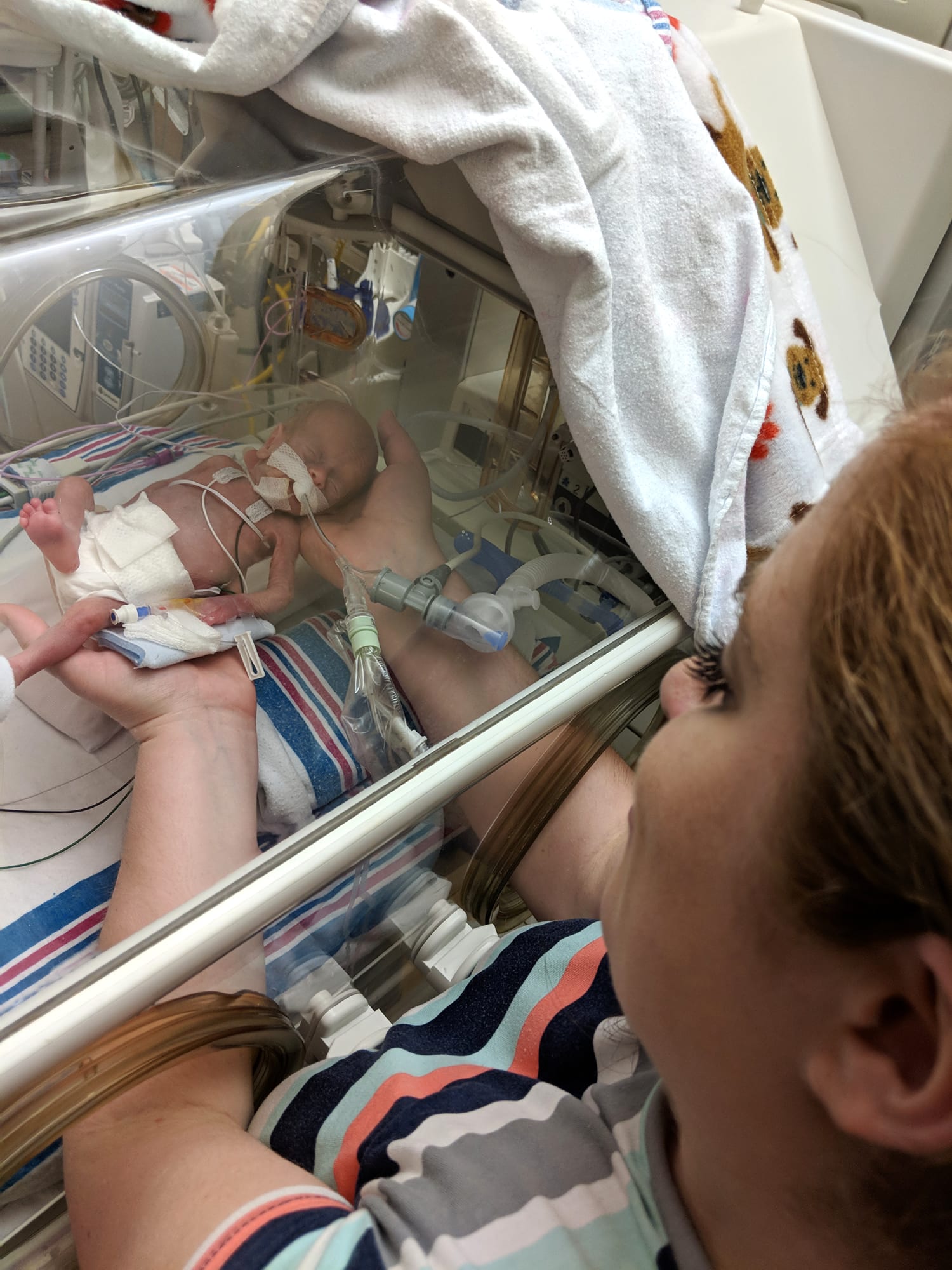 From 11 Ounces To 11 Pounds Baby Returns Home Against Odds